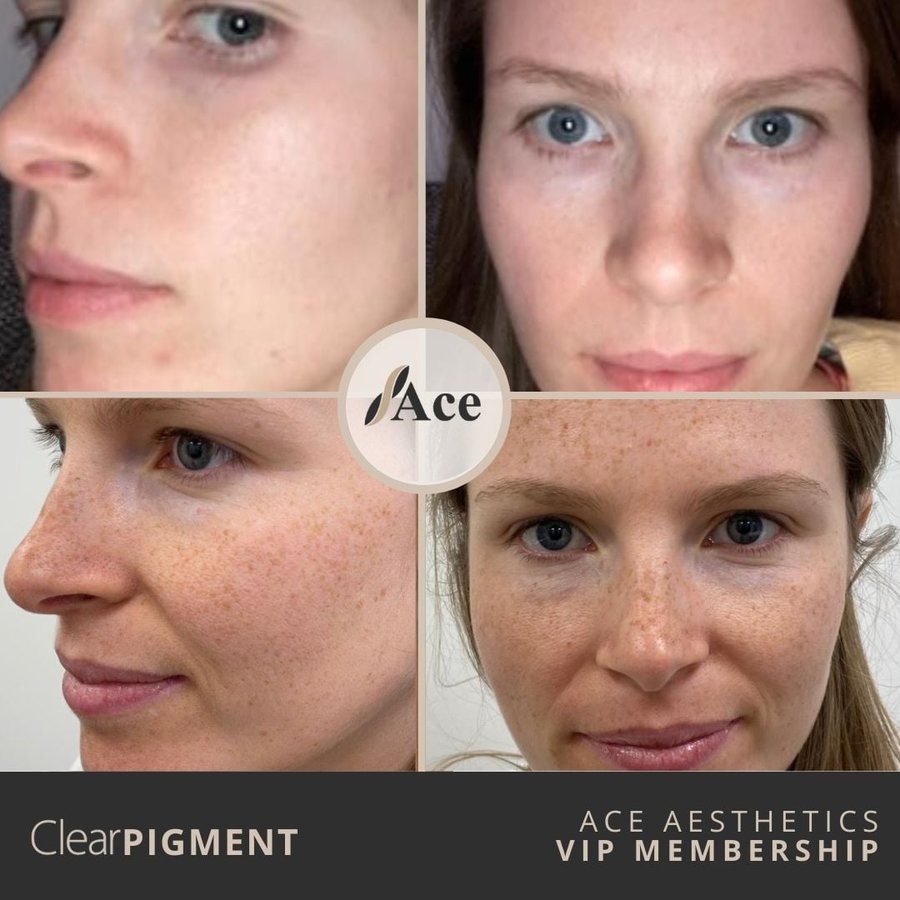 Ace Aesthetics - Ace Aesthetics